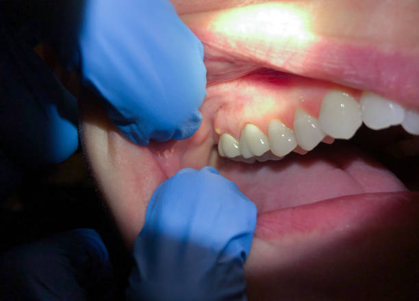 Professional Emergency Dentist in NJ
